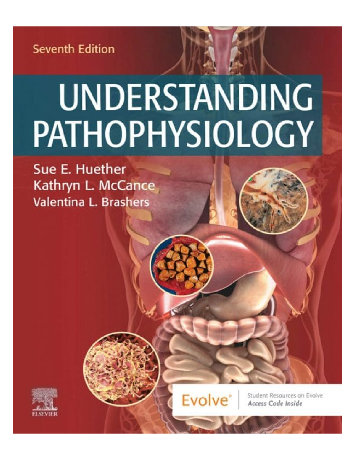 Preview of UNDERSTANDING PATHOPHYSIOLOGY 7TH EDITION TEST BANK
